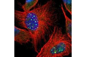 Immunofluorescent staining of human cell line U-251 MG with CTCFL polyclonal antibody  at 1-4 ug/mL dilution shows positivity in nucleus, cytoplasm. (CTCFL Antikörper)