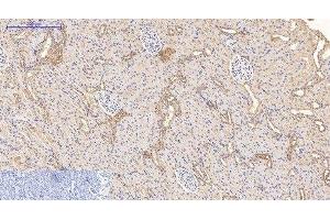 Immunohistochemistry of paraffin-embedded Rat kidney tissue using CD21 Monoclonal Antibody at dilution of 1:200. (CD21 Antikörper)