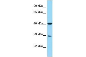 WB Suggested Anti-FCGR3A Antibody Titration: 1. (FCGR3A Antikörper  (Middle Region))