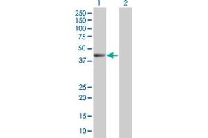 Western Blot analysis of WDR67 expression in transfected 293T cell line by WDR67 MaxPab polyclonal antibody. (TBC1D31 Antikörper  (AA 1-340))