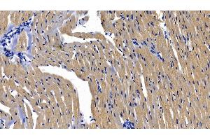 Detection of MyD88 in Rat Cardiac Muscle Tissue using Polyclonal Antibody to Myeloid Differentiation Factor 88 (MyD88) (MYD88 Antikörper  (AA 1-296))