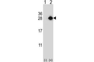 Western blot analysis of YEATS4 (arrow) using rabbit polyclonal YEATS4 Antibody . (GAS41 Antikörper)
