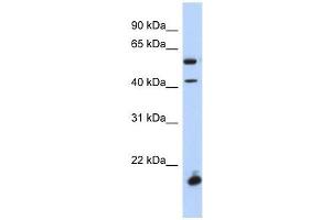 DBX1 antibody used at 0. (DBX1 Antikörper  (Middle Region))