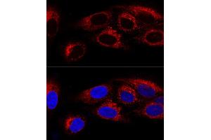 Confocal immunofluorescence analysis of U2OS cells using CK Polyclonal Antibody (ABIN6134474, ABIN6138645, ABIN6138646 and ABIN6223731) at dilution of 1:100. (CKAP4 Antikörper)