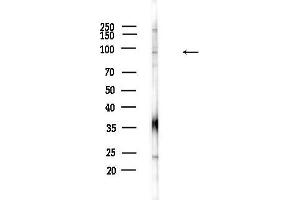 anti-Interferon, gamma-Inducible Protein 16 (IFI16) (C-Term) antibody