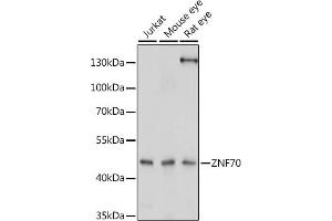 Western blot analysis of extracts of various cell lines, using ZNF70 antibody (ABIN7271522) at 1:1000 dilution. (ZNF70 Antikörper  (AA 1-140))