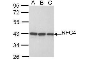 WB Image Sample (30 ug of whole cell lysate) A: H1299 B: Hela C: Hep G2 , 10% SDS PAGE antibody diluted at 1:1000 (RFC4 Antikörper)