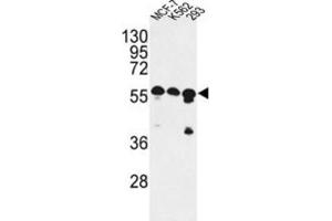 Western Blotting (WB) image for anti-CCR4-NOT Transcription Complex Subunit 4 (CNOT4) antibody (ABIN2998123) (CNOT4 Antikörper)