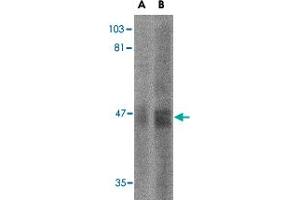 Western blot analysis of SIRT2 in human brain tissue lysate with SIRT2 polyclonal antibody  at (A) 2.
