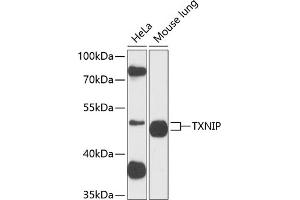 Western blot analysis of extracts of Rat uterus, using TXNIP antibody (ABIN6130776, ABIN6149733, ABIN6149734 and ABIN6224986) at 1:890 dilution. (TXNIP Antikörper  (AA 1-166))