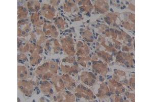 Used in DAB staining on fromalin fixed paraffin- embedded Kidney tissue (CBR1 Antikörper  (AA 2-277))