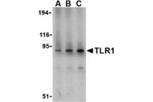 Image no. 1 for anti-Toll-Like Receptor 1 (TLR1) (N-Term) antibody (ABIN318756) (TLR1 Antikörper  (N-Term))