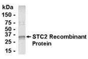Western Blotting (WB) image for anti-Stanniocalcin 2 (STC2) (AA 20-302) antibody (ABIN2468046) (Stanniocalcin 2 Antikörper  (AA 20-302))