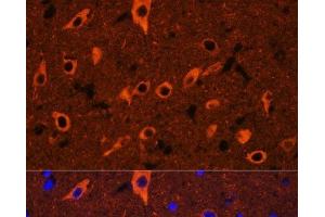 Immunofluorescence analysis of Rat brain using TUBB3 Polyclonal Antibody at dilution of 1:100. (TUBB3 Antikörper)