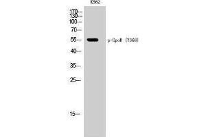 Western Blotting (WB) image for anti-Erythropoietin Receptor (EPOR) (pTyr368) antibody (ABIN3173177) (EPOR Antikörper  (pTyr368))