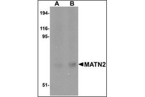 Western blot analysis of MATN2 in human liver tissue lysate with this product at (A) 1 and (B) 2 μg/ml. (MATN2 Antikörper  (C-Term))