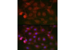 Immunofluorescence analysis of C6 cells using SSR2 Rabbit pAb (ABIN7270299) at dilution of 1:100 (40x lens). (SSR2 Antikörper)