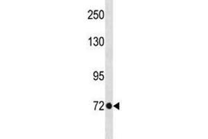 TBR2 antibody western blot analysis in A375 lysate. (EOMES Antikörper  (AA 28-57))