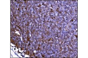 IHC analysis of FABP-1/GOT2 using anti-FABP-1/GOT2 antibody (ABIN7601426). (GOT2 Antikörper  (AA 35-430))