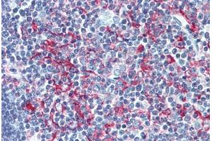 Human Thymus (formalin-fixed, paraffin-embedded) stained with LSP1 antibody ABIN305891 at 1:100 followed by biotinylated goat anti-rabbit IgG secondary antibody ABIN481713, alkaline phosphatase-streptavidin and chromogen.
