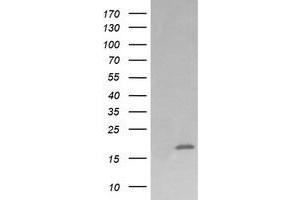 Image no. 5 for anti-Cancer/testis Antigen 1B (CTAG1B) antibody (ABIN1499906)
