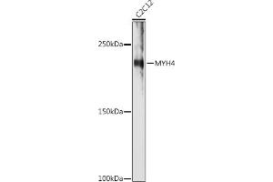 Western blot analysis of extracts of C2C12 cells, using MYH4 antibody (ABIN7268749) at 1:1000 dilution. (MYH4 Antikörper  (AA 1450-1550))