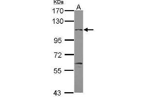 WB Image Sample (30 ug of whole cell lysate) A: U87-MG 7. (GABBR2 Antikörper)