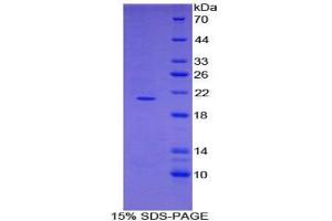 SDS-PAGE analysis of Mouse ADAMTS2 Protein. (Adamts2 Protein)