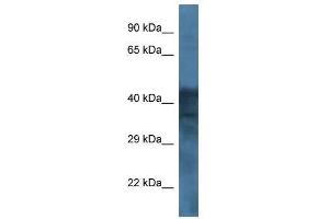 Western Blot showing GABRB1 antibody used at a concentration of 1.