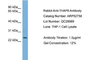 WB Suggested Anti-THAP6  Antibody Titration: 0. (THAP6 Antikörper  (Middle Region))