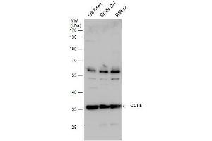 WB Image CCR5 antibody detects CCR5 protein by western blot analysis. (CCR5 Antikörper  (Center))
