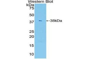 Western Blotting (WB) image for anti-V-Akt Murine Thymoma Viral Oncogene Homolog 3 (Protein Kinase B, Gamma) (AKT3) (AA 46-338) antibody (ABIN1860234)