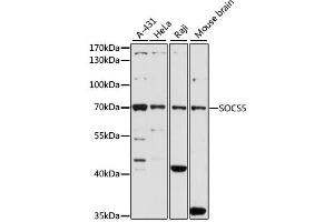 Western blot analysis of extracts of various cell lines, using SOCS5 antibody.