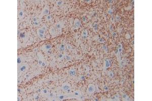 IHC-P analysis of Human Tissue, with DAB staining. (SLC1A6 Antikörper  (AA 156-264))