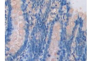 Immunohistochemistry (IHC) image for anti-Pannexin 1 (PANX1) (AA 77-260) antibody (ABIN7439189)