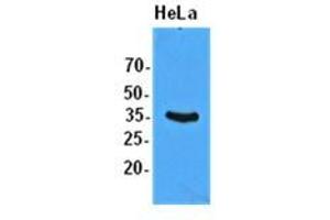 Western Blotting (WB) image for anti-Eukaryotic Translation Initiation Factor 2 Subunit 1 (EIF2S1) antibody (ABIN781544) (EIF2S1 Antikörper)