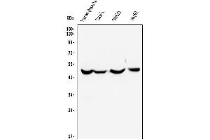 Western blot analysis of EDNRB using anti-EDNRB antibody (ABIN6719561).