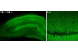 Immunohistochemistry (IHC) image for anti-Calcium Channel, Voltage-Dependent, N Type, alpha 1B Subunit (CACNA1B) (AA 1921-2222) antibody (ABIN1742328)