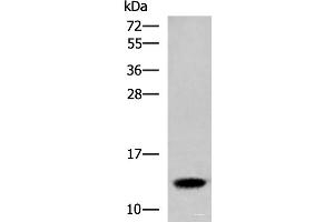 Western blot analysis of Human placenta tissue lysate using HBE1 Polyclonal Antibody at dilution of 1:300