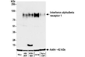 Western Blotting (WB) image for anti-Interferon alpha/beta Receptor 1 (IFNAR1) (AA 27-436) antibody (ABIN7795662)