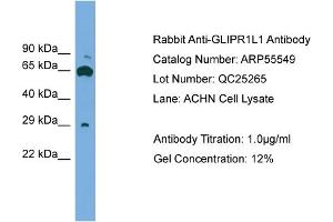 WB Suggested Anti-GLIPR1L1  Antibody Titration: 0.