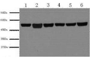 Western Blot analysis of A549, Rat brain, Mouse brain, Chicken lung, Rabbit testis, Sheep muscle using beta Tubulin Monoclonal Antibody at dilution of 1:5000. (TUBB Antikörper)