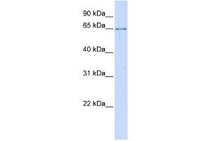 ALG6 antibody used at 1 ug/ml to detect target protein. (ALG6 Antikörper)