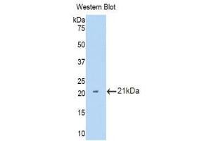 Western Blotting (WB) image for anti-Interleukin 12 Receptor, beta 2 (IL12RB2) (AA 455-606) antibody (ABIN3207279) (IL12RB2 Antikörper  (AA 455-606))