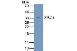 Detection of Recombinant UCP4, Human using Polyclonal Antibody to Uncoupling Protein 4, Mitochondrial (UCP4) (SLC25A27 Antikörper  (AA 21-317))