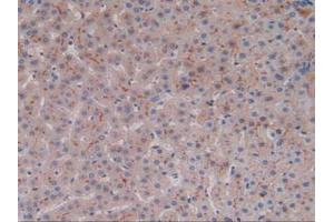 IHC-P analysis of Human Liver Tissue, with DAB staining. (ALT Antikörper  (AA 581-738))