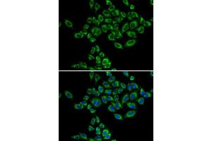 Immunofluorescence analysis of HeLa cells using SRPK1 antibody. (SRPK1 Antikörper)