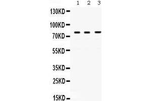 Western Blotting (WB) image for anti-Polymerase (DNA Directed), eta (POLH) (AA 157-361) antibody (ABIN3042492)