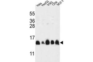 Western Blotting (WB) image for anti-Histone Cluster 1, H2al (HIST1H2AL) antibody (ABIN3002161) (HIST1H2AL Antikörper)
