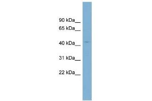 WB Suggested Anti-CRBN Antibody Titration: 0. (CRBN Antikörper  (N-Term))